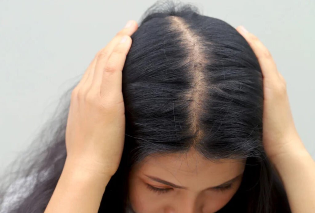 Hair loss pathological