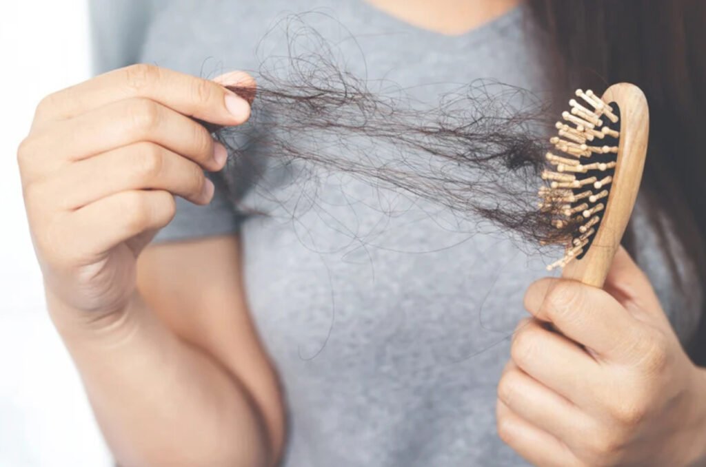 hair loss